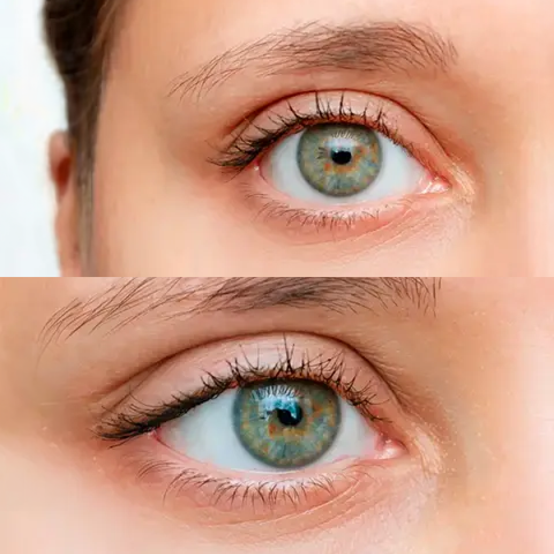 Liora® - Eye Lift – 240 patches