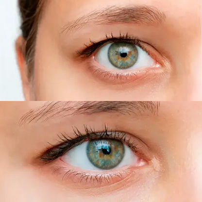 Liora® - Eye Lift – 240 patches